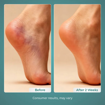 Gatherlux™ - MuscleRelief Pro